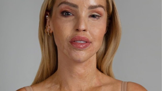 Katie Piper
