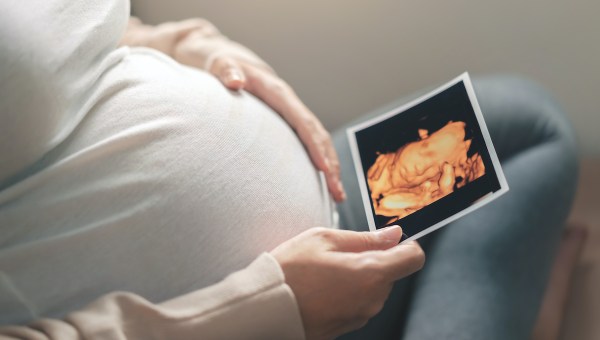 Corner Item Image - Pričakujete dojenčka? Tu je nekaj uporabnih aplikacij za spremljanje nosečnosti