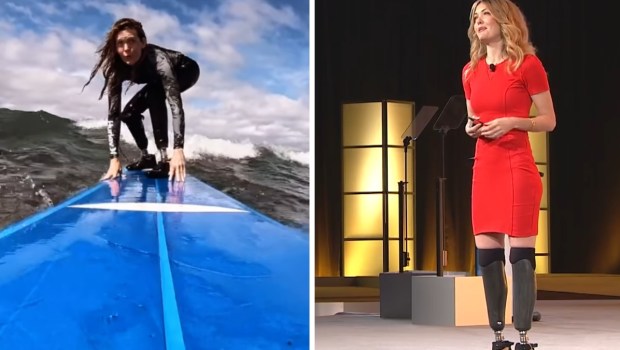 amypurdy